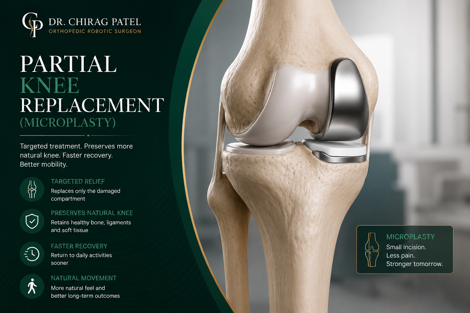 Partial Knee Surgery